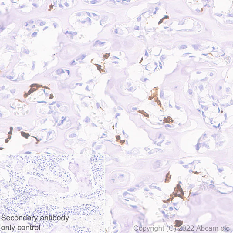 Immunohistochemistry (Formalin/PFA-fixed paraffin-embedded sections) - Anti-Cathepsin K antibody [EPR24829-101] (AB300569)