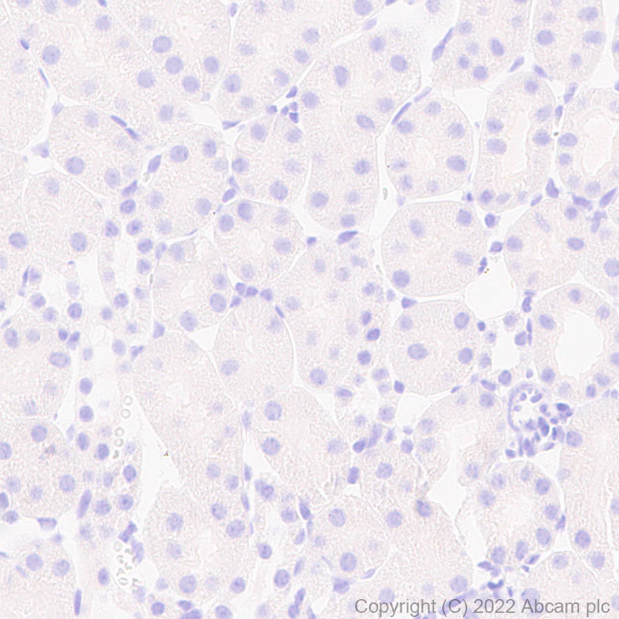 Immunohistochemistry (Formalin/PFA-fixed paraffin-embedded sections) - Anti-Cathepsin K antibody [EPR24829-101] (AB300569), expandable thumbnail