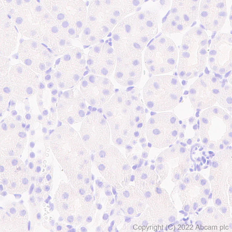 Immunohistochemistry (Formalin/PFA-fixed paraffin-embedded sections) - Anti-Cathepsin K antibody [EPR24829-101] (AB300569)