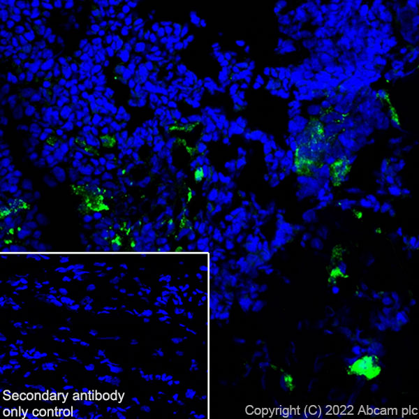 Immunohistochemistry (Frozen sections) - Anti-Cathepsin K antibody [EPR24829-101] (AB300569), expandable thumbnail