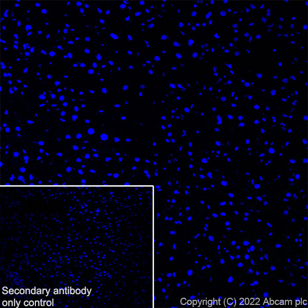 Immunohistochemistry (Frozen sections) - Anti-Cathepsin K antibody [EPR24829-101] (AB300569), expandable thumbnail