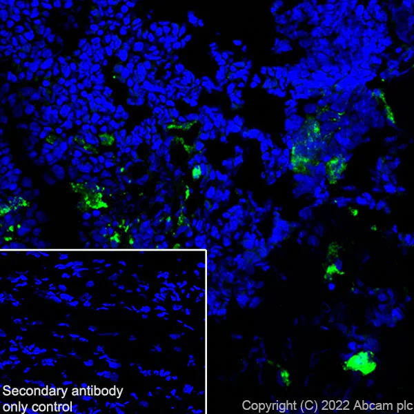 Immunohistochemistry (Frozen sections) - Anti-Cathepsin K antibody [EPR24829-101] (BSA and Azide free) (AB300570)