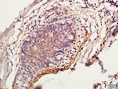 Immunohistochemistry (Formalin/PFA-fixed paraffin-embedded sections) - Anti-Cathepsin L/MEP antibody (AB203028)