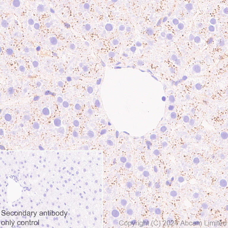 Immunohistochemistry (Formalin/PFA-fixed paraffin-embedded sections) - Anti-Cathepsin L/MEP antibody [EPR29413-573] (AB321872)