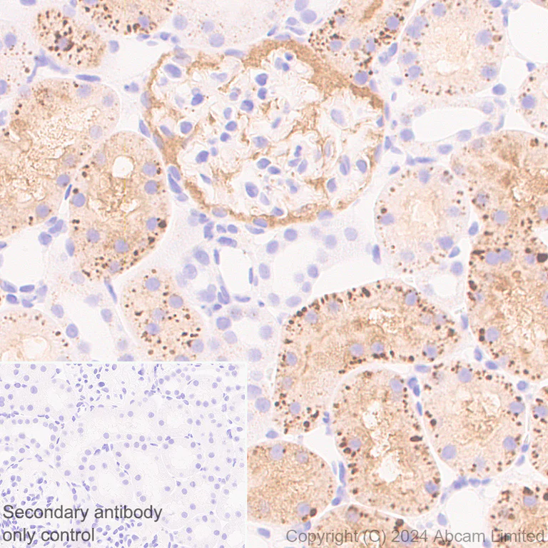 Immunohistochemistry (Formalin/PFA-fixed paraffin-embedded sections) - Anti-Cathepsin L/MEP antibody [EPR29413-573] (AB321872)