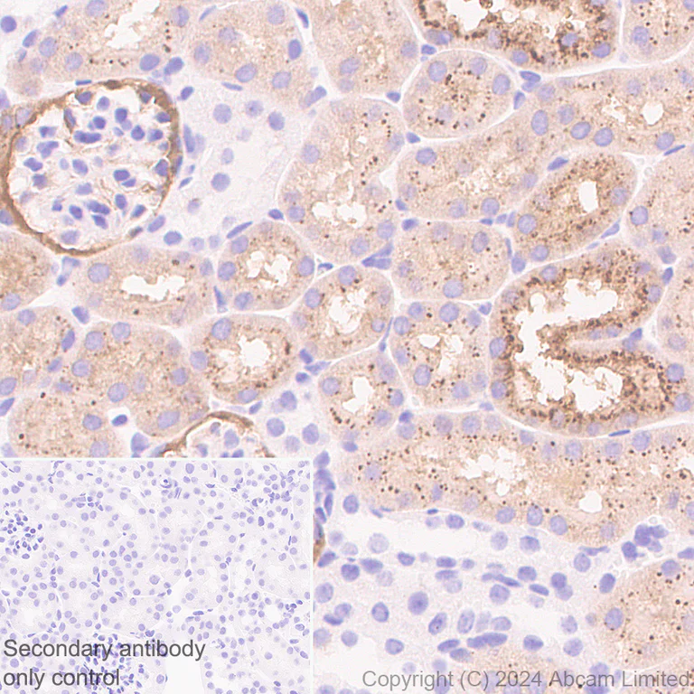 Immunohistochemistry (Formalin/PFA-fixed paraffin-embedded sections) - Anti-Cathepsin L/MEP antibody [EPR29413-573] - BSA and Azide free (AB321873)