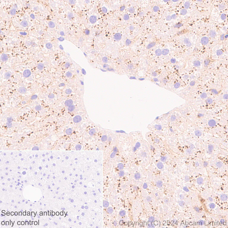 Immunohistochemistry (Formalin/PFA-fixed paraffin-embedded sections) - Anti-Cathepsin L/MEP antibody [EPR29413-573] - BSA and Azide free (AB321873)