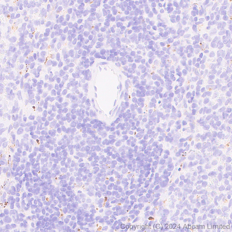 Immunohistochemistry (Formalin/PFA-fixed paraffin-embedded sections) - Anti-Cathepsin L/MEP antibody [EPR29413-573] - BSA and Azide free (AB321873)