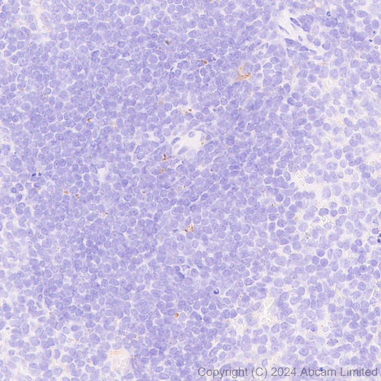 Immunohistochemistry (Formalin/PFA-fixed paraffin-embedded sections) - Anti-Cathepsin L/MEP antibody [EPR29413-573] - BSA and Azide free (AB321873)