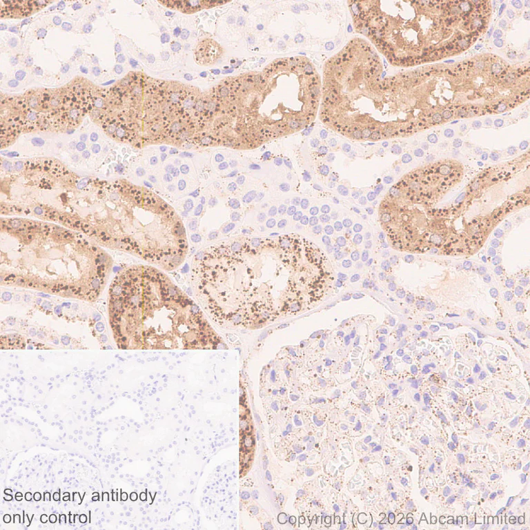 Immunohistochemistry (Formalin/PFA-fixed paraffin-embedded sections) - Anti-Cathepsin L/MEP antibody [EPR30887-518] (AB326362)