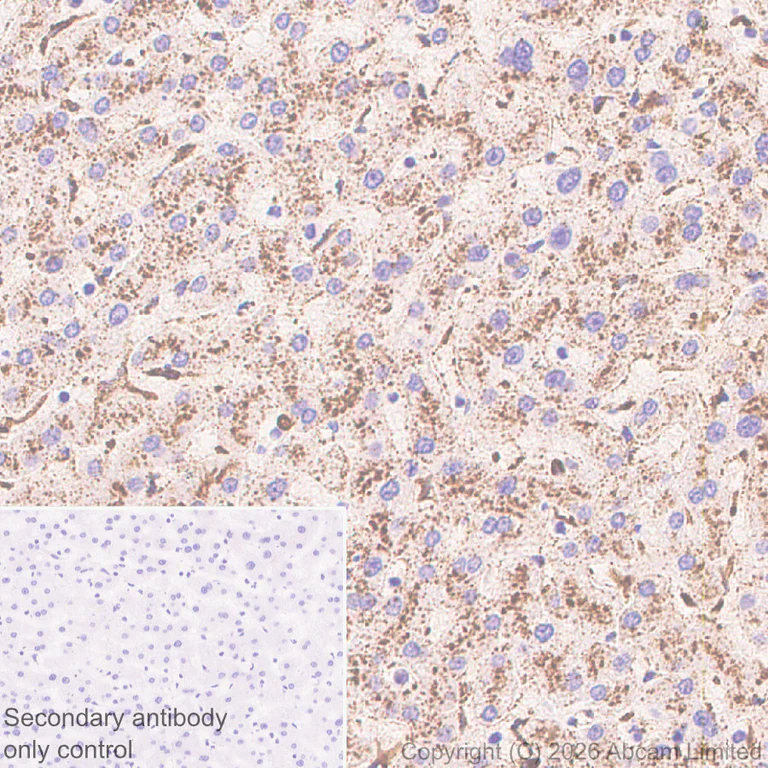 Immunohistochemistry (Formalin/PFA-fixed paraffin-embedded sections) - Anti-Cathepsin L/MEP antibody [EPR30887-518] (AB326362)