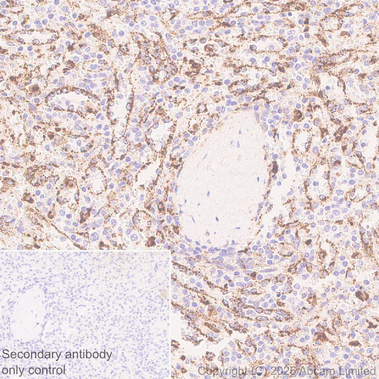 Immunohistochemistry (Formalin/PFA-fixed paraffin-embedded sections) - Anti-Cathepsin L/MEP antibody [EPR30887-518] (AB326362)