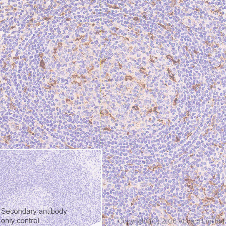 Immunohistochemistry (Formalin/PFA-fixed paraffin-embedded sections) - Anti-Cathepsin L/MEP antibody [EPR30887-518] (AB326362)