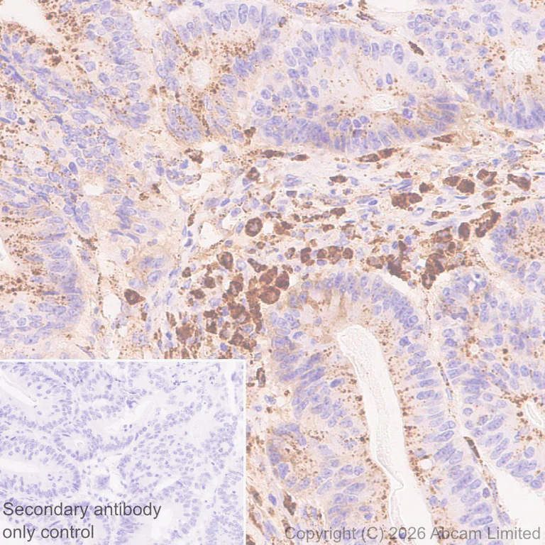 Immunohistochemistry (Formalin/PFA-fixed paraffin-embedded sections) - Anti-Cathepsin L/MEP antibody [EPR30887-518] (AB326362)