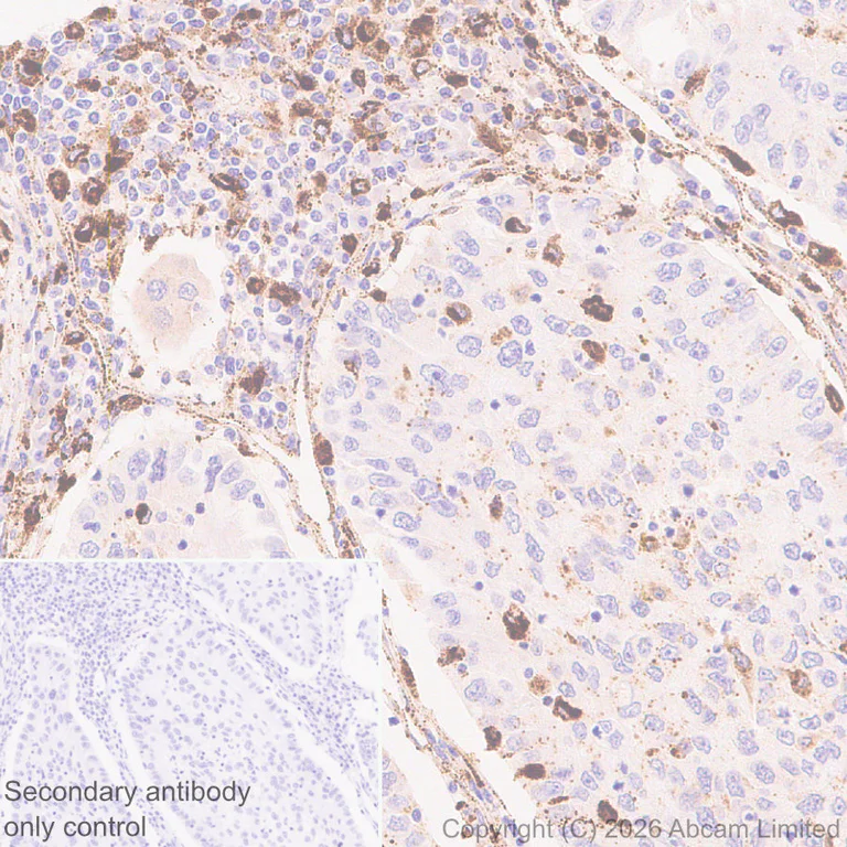 Immunohistochemistry (Formalin/PFA-fixed paraffin-embedded sections) - Anti-Cathepsin L/MEP antibody [EPR30887-518] (AB326362)