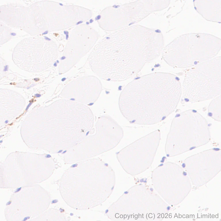 Immunohistochemistry (Formalin/PFA-fixed paraffin-embedded sections) - Anti-Cathepsin L/MEP antibody [EPR30887-518] (AB326362)