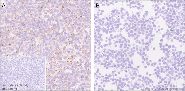 Immunohistochemistry (Formalin/PFA-fixed paraffin-embedded sections) - Anti-Cathepsin L/MEP antibody [EPR30887-518] (AB326362)