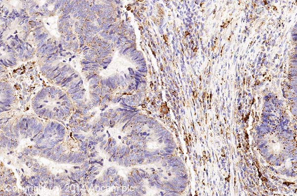 Immunohistochemistry (Formalin/PFA-fixed paraffin-embedded sections) - Anti-Cathepsin L + V antibody [33/2] (AB6314), expandable thumbnail