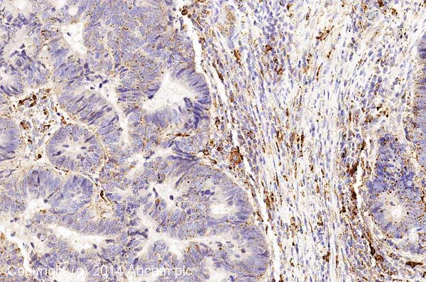 Immunohistochemistry (Formalin/PFA-fixed paraffin-embedded sections) - Anti-Cathepsin L + V antibody [33/2] (AB6314)