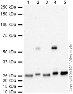 Western blot - Anti-Cathepsin L + V antibody [33/2] (AB6314), expandable thumbnail