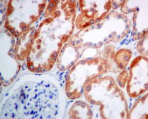 Immunohistochemistry (Formalin/PFA-fixed paraffin-embedded sections) - Anti-Cathepsin L/V/K/H antibody [EPR8011] (ab133641), expandable thumbnail