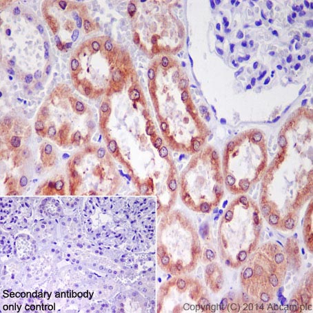 Immunohistochemistry (Formalin/PFA-fixed paraffin-embedded sections) - Anti-Cathepsin L/V/K/H antibody [EPR8011] (ab133641), expandable thumbnail