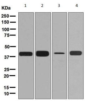 Western blot - Anti-Cathepsin L/V/K/H antibody [EPR8011] (ab133641), expandable thumbnail