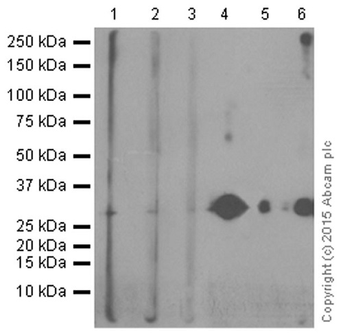Western blot - Anti-Cathepsin L/V/K/H antibody [EPR8011] (AB133641), expandable thumbnail