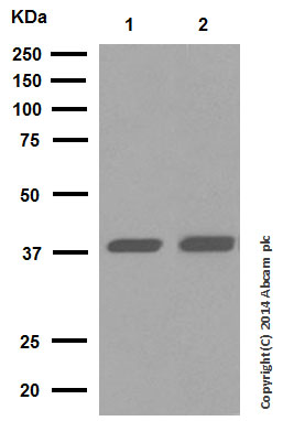 Western blot - Anti-Cathepsin L/V/K/H antibody [EPR8011] (ab133641), expandable thumbnail