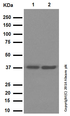 Western blot - Anti-Cathepsin L/V/K/H antibody [EPR8011] (ab133641), expandable thumbnail