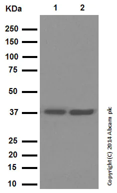 Western blot - Anti-Cathepsin L/V/K/H antibody [EPR8011] (AB133641)