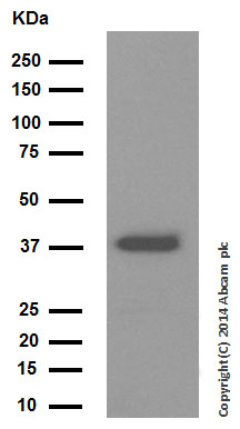 Western blot - Anti-Cathepsin L/V/K/H antibody [EPR8011] (ab133641), expandable thumbnail