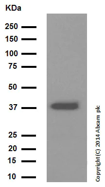 Western blot - Anti-Cathepsin L/V/K/H antibody [EPR8011] (AB133641)