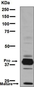 Western blot - Anti-Cathepsin L/V/K/H antibody [EPR8011] (ab133641), expandable thumbnail