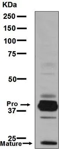 Western blot - Anti-Cathepsin L/V/K/H antibody [EPR8011] (AB133641)