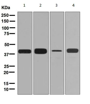 Western blot - Anti-Cathepsin L/V/K/H antibody [EPR8011] - BSA and Azide free (AB248589)