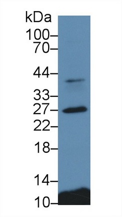 Western blot - Anti-Cathepsin S antibody (AB232740), expandable thumbnail