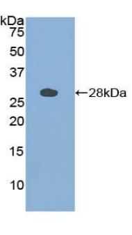 Western blot - Anti-Cathepsin S antibody (AB232740), expandable thumbnail