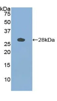 Western blot - Anti-Cathepsin S antibody (AB232740)