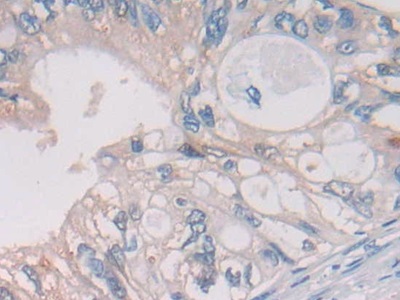 Immunohistochemistry (Formalin/PFA-fixed paraffin-embedded sections) - Anti-Cathepsin S antibody (AB232830), expandable thumbnail