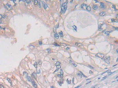 Immunohistochemistry (Formalin/PFA-fixed paraffin-embedded sections) - Anti-Cathepsin S antibody (AB232830)