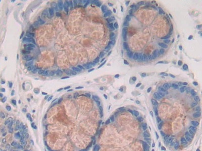 Immunohistochemistry (Formalin/PFA-fixed paraffin-embedded sections) - Anti-Cathepsin S antibody (AB232830), expandable thumbnail
