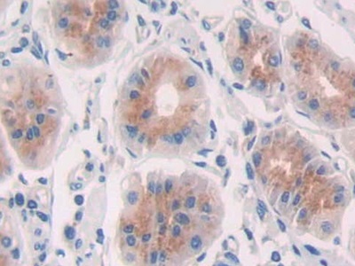 Immunohistochemistry (Formalin/PFA-fixed paraffin-embedded sections) - Anti-Cathepsin S antibody (AB232830), expandable thumbnail