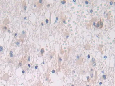 Immunohistochemistry (Formalin/PFA-fixed paraffin-embedded sections) - Anti-Cathepsin S antibody (AB232830)