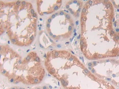 Immunohistochemistry (Formalin/PFA-fixed paraffin-embedded sections) - Anti-Cathepsin S antibody (AB232830)