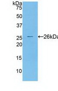Western blot - Anti-Cathepsin S antibody (ab232830), expandable thumbnail