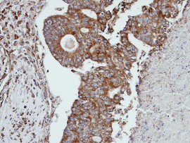 Immunohistochemistry (Formalin/PFA-fixed paraffin-embedded sections) - Anti-Cathepsin S antibody (AB96788), expandable thumbnail