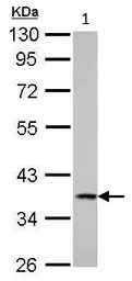 Western blot - Anti-Cathepsin S antibody (AB96788)