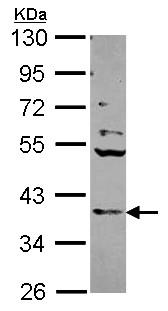 Western blot - Anti-Cathepsin S antibody (AB96788), expandable thumbnail