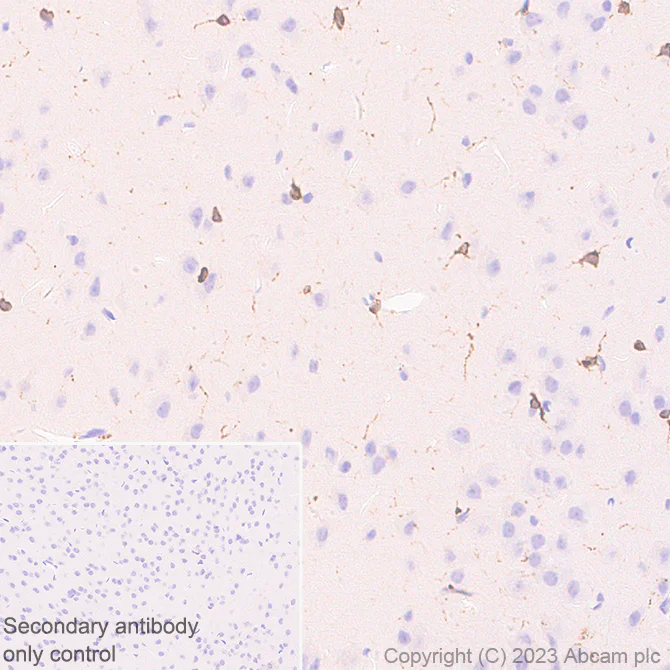 Immunohistochemistry (Formalin/PFA-fixed paraffin-embedded sections) - Anti-Cathepsin S antibody [EPR26156-57] (AB309090)